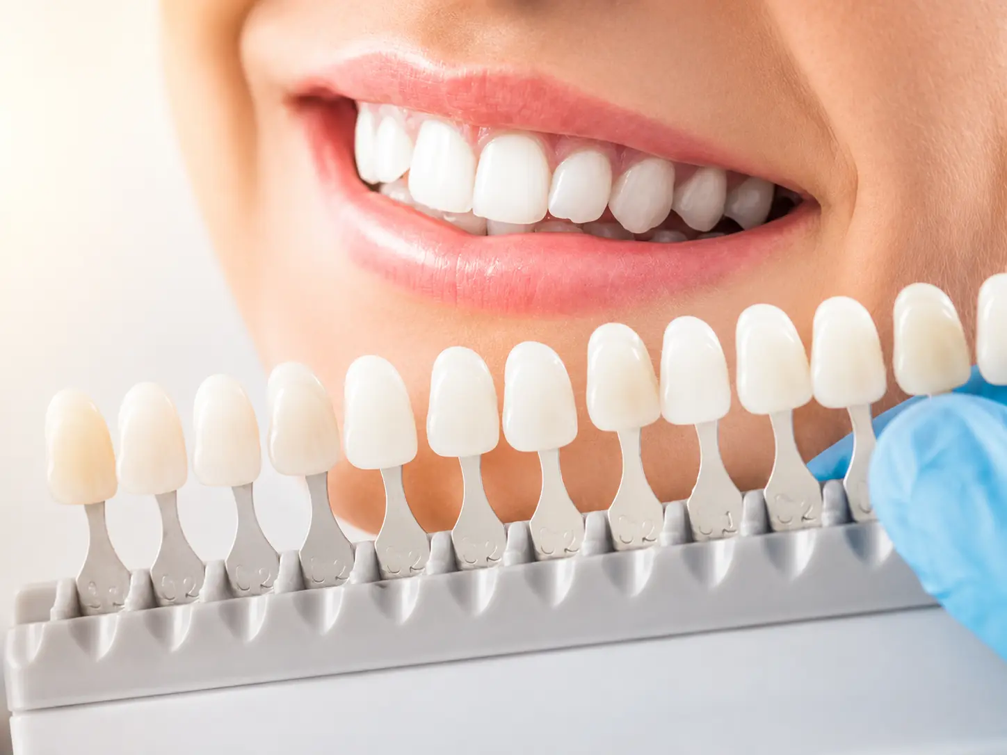 Cosmetic dentistry and smile makeover in Kishangarh